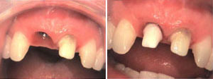 contour_specialists_implants_mouth