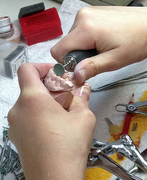 contour_specialists_dental_lab_grinding